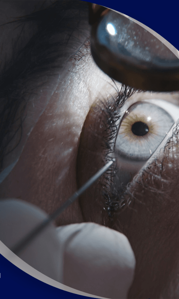 أفضل دكتور تصحيح نظر في الحبيب