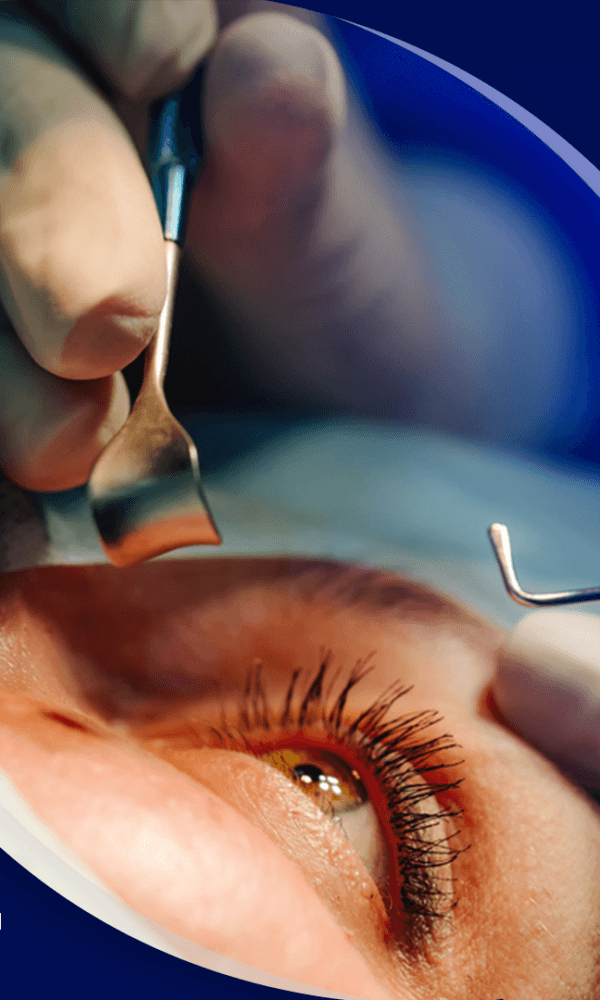 أفضل دكتور عيون في الرياض