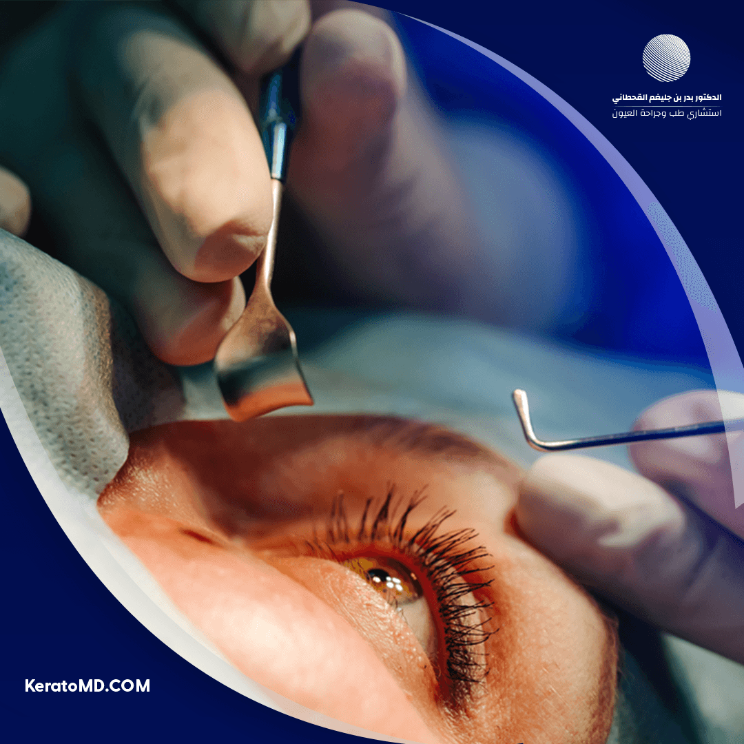 أفضل دكتور عيون في الرياض